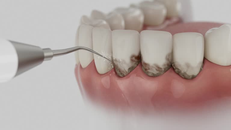 Reliable Dental Implants contractor in Cayce, SC by Smile Center Dentistry